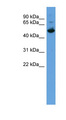 ALDH3A1 Antibody - ALDH3A1 antibody Western blot of Fetal Liver lysate. This image was taken for the unconjugated form of this product. Other forms have not been tested.
