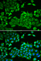ALDH3A1 Antibody - Immunofluorescence analysis of HeLa cells.