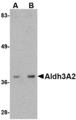 ALDH3A2 Antibody - Western blot of Aldh3A2 in mouse liver lysate with Aldh3A2 antibody at (A) 1 and (B) 2 ug/ml.