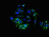 ALDH3B1 Antibody - Immunofluorescent analysis of A549 cells at a dilution of of 1:100 and Alexa Fluor 488-congugated AffiniPure Goat Anti-Rabbit IgG(H+L)