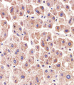 ALDH6A1 Antibody - Immunohistochemical of paraffin-embedded H.liver section using ALDH6A1 Antibody. Antibody was diluted at 1:25 dilution. A peroxidase-conjugated goat anti-rabbit IgG at 1:400 dilution was used as the secondary antibody, followed by DAB staining.