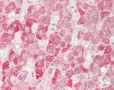 ALDH7A1 Antibody - Human Liver: Formalin-Fixed, Paraffin-Embedded (FFPE).  This image was taken for the unconjugated form of this product. Other forms have not been tested.