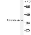 ALDOA / Aldolase A Antibody - Western blot of Aldolase A (T9) pAb in extracts from COLO205 cells.