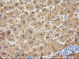 ALDOB Antibody - IHC of paraffin-embedded Human liver tissue using anti-ALDOB mouse monoclonal antibody.