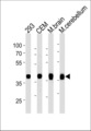 ALDOC / Aldolase C Antibody - ALDOC Antibody western blot of 293,CEM cell line and mouse brain,cerebellum tissue lysates (35 ug/lane). The ALDOC antibody detected the ALDOC protein (arrow).