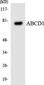ALDP / ABCD1 Antibody - Western blot analysis of the lysates from HeLa cells using ABCD1 antibody.