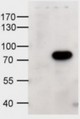 ALDP / ABCD1 Antibody - HEK293 overexpressing human ABCD1 and probed with the antibody at 1 ug/ml (mock transfection in first lane).