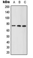 ALDP / ABCD1 Antibody - Western blot analysis of ABCD1 expression in HeLa (A); mouse brain (B); rat kidney (C) whole cell lysates.