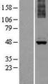 ALG1 Protein - Western validation with an anti-DDK antibody * L: Control HEK293 lysate R: Over-expression lysate