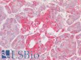 ALG11 Antibody - Human Pancreas, Islets of Langerhans: Formalin-Fixed, Paraffin-Embedded (FFPE)