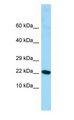 ALG13 Antibody - ALG13 antibody Western Blot of Fetal Stomach.  This image was taken for the unconjugated form of this product. Other forms have not been tested.