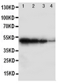 ALK-6 / BMPR1B Antibody - Anti-BMPR1B antibody, Western blottingRecombinant Protein Detection Source: E. coli derived -recombinant Human BMPR1B, 49. 0KD (162aa tag+D17-D289)Lane 1: Recombinant Human BMPR1B Protein 10ng Lane 2: Recombinant Human BMPR1B Protein 5ng Lane 3: Recombinant Human BMPR1B Protein 2. 5ng Lane 4: Recombinant Human BMPR1B Protein 1. 25ng