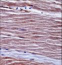 ALK2 / ACVR1 Antibody - Mouse Acvr1 Antibody immunohistochemistry of formalin-fixed and paraffin-embedded mouse skeletal muscle followed by peroxidase-conjugated secondary antibody and DAB staining.