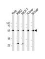 ALK3 / BMPR1A Antibody - Western blot of lysates from HeLa, K562, MCF-7 cell line, human liver, mouse liver tissue lysate(from left to right), using BMPR1A Antibody(A13). Antibody was diluted at 1:1000 at each lane. A goat anti-rabbit IgG H&L (HRP) at 1:10000 dilution was used as the secondary antibody. Lysates at 35ug per lane.