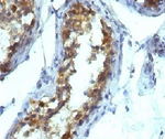 Alkaline Phosphatase Antibody - IHC testing of FFPE testicular carcinoma and Alkaline Phosphatase antibody (KSUL-1). Required HIER: boil tissue sections in 10mM Tris with 1mM EDTA, pH 9, for 10-20 min followed by cooling at RT for 20 min.