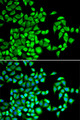 ALKBH1 / ALKB Antibody - Immunofluorescence analysis of U2OS cells using ALKBH1 antibody. Blue: DAPI for nuclear staining.