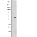 ALKBH5 Antibody - Western blot analysis of ALKBH5 expression in 293 cells line lysate. The lane on the left is treated with the antigen-specific peptide.