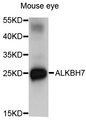ALKBH7 Antibody - Western blot analysis of extracts of Mouse eye cells.