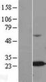 ALKBH7 Protein - Western validation with an anti-DDK antibody * L: Control HEK293 lysate R: Over-expression lysate