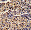 ALKBH8 Antibody - Formalin-fixed and paraffin-embedded human spleen reacted with ALKBH8 Antibody , which was peroxidase-conjugated to the secondary antibody, followed by DAB staining. This data demonstrates the use of this antibody for immunohistochemistry; clinical relevance has not been evaluated.
