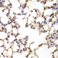 ALOX15B / 15-LOX-2 Antibody - Immunohistochemistry of paraffin-embedded Mouse lung tissue.