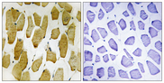 ALOX5 / 5-LOX Antibody - Immunohistochemistry analysis of paraffin-embedded human skeletal muscle, using Arachidonate 5 Lipoxygenase (Phospho-Ser271) Antibody. The picture on the right is blocked with the phospho peptide.