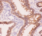 Alpha Catenin Antibody - IHC-P staining of rat intestine tissue