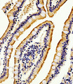 ALPI / Alkaline Phosphatase Antibody - Immunohistochemical of paraffin-embedded H. small intestine section using Alkaline Phosphatase (ALPI) Antibody. Antibody was diluted at 1:100 dilution. A peroxidase-conjugated goat anti-rabbit IgG at 1:400 dilution was used as the secondary antibody, followed by DAB staining.