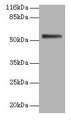 ALPI / Alkaline Phosphatase Antibody - Western blot All lanes: Intestinal-type alkaline phosphatase antibody at 2µg/ml + 293T whole cell lysate Secondary Goat polyclonal to rabbit IgG at 1/10000 dilution Predicted band size: 58 kDa Observed band size: 58 kDa