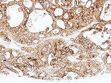 ALPPL2 Antibody - IHC of paraffin-embedded Breast using ALPPL2 antibody at 1:500 dilution.