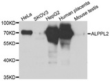 ALPPL2 Antibody - Western blot analysis of extracts of various cell lines.