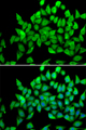 ALS2 / Alsin Antibody - Immunofluorescence analysis of A549 cells.