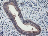 ALS2CR1 / NIF3L1 Antibody - IHC of paraffin-embedded Human endometrium tissue using anti-NIF3L1 mouse monoclonal antibody.