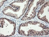 ALS2CR1 / NIF3L1 Antibody - IHC of paraffin-embedded Human prostate tissue using anti-NIF3L1 mouse monoclonal antibody.