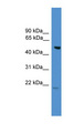 ALS2CR12 Antibody - ALS2CR12 antibody Western blot of A549 cell lysate. This image was taken for the unconjugated form of this product. Other forms have not been tested.