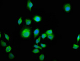 ALS2CR12 Antibody - Immunofluorescence staining of A549 cells at a dilution of 1:100, counter-stained with DAPI. The cells were fixed in 4% formaldehyde, permeabilized using 0.2% Triton X-100 and blocked in 10% normal Goat Serum. The cells were then incubated with the antibody overnight at 4 °C.The secondary antibody was Alexa Fluor 488-congugated AffiniPure Goat Anti-Rabbit IgG (H+L) .