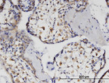 ALX / HSH2D Antibody - Immunoperoxidase of monoclonal antibody to HSH2D on formalin-fixed paraffin-embedded human placenta. [antibody concentration 3 ug/ml]