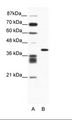 ALX4 Antibody - A: Marker, B: Jurkat Cell Lysate.  This image was taken for the unconjugated form of this product. Other forms have not been tested.