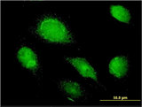 AMBP  Antibody - Immunofluorescence of monoclonal antibody to AMBP on HeLa cell. [antibody concentration 10 ug/ml]