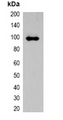 AmCyan Tag Antibody - Western blot analysis of over-expressed AmCyan-tagged protein in 293T cell lysate.