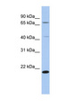 AMD / AMD1 Antibody - AMD1 antibody Western blot of THP-1 cell lysate. This image was taken for the unconjugated form of this product. Other forms have not been tested.