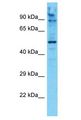 AMPD1 Antibody - AMPD1 / MAD antibody Western Blot of 293T. Antibody dilution: 1 ug/ml.  This image was taken for the unconjugated form of this product. Other forms have not been tested.