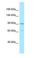 AMPD2 Antibody - AMPD2 antibody Western Blot of HeLa.  This image was taken for the unconjugated form of this product. Other forms have not been tested.