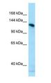 AMPD2 Antibody - AMPD2 antibody Western Blot of MCF7.  This image was taken for the unconjugated form of this product. Other forms have not been tested.