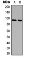 AMPD2 Antibody - Western blot analysis of AMPD2 expression in MCF7 (A); HeLa (B) whole cell lysates.