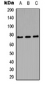 AMPH / Amphiphysin Antibody - Western blot analysis of Amphiphysin 1 expression in SHSYS5 (A); mouse brain (B); PC12 (C) whole cell lysates.