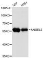 ANGEL2 Antibody - Western blot analysis of extracts of various cell lines, using ANGEL2 antibody at 1:3000 dilution. The secondary antibody used was an HRP Goat Anti-Rabbit IgG (H+L) at 1:10000 dilution. Lysates were loaded 25ug per lane and 3% nonfat dry milk in TBST was used for blocking. An ECL Kit was used for detection and the exposure time was 90s.