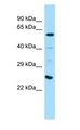 ANGPT1 / Angiopoietin-1 Antibody - ANGPT1 / ANG1 / Angiopoietin-1 antibody Western Blot of Mouse Liver.  This image was taken for the unconjugated form of this product. Other forms have not been tested.