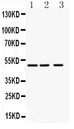 ANGPTL4 Antibody - anti-ANGPTL4 antibody, Western blotting All lanes: Anti ANGPTL4 at 0.5ug/ml Lane 1: Human Placenta Tissue Lysate at 50ugLane 2: SMMC Whole Cell Lysate at 40ugLane 3: HELA Whole Cell Lysate at 40ugPredicted bind size: 50KD Observed bind size: 50KD