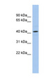 ANGPTL5 Antibody - ANGPTL5 antibody Western blot of HeLa lysate. This image was taken for the unconjugated form of this product. Other forms have not been tested.